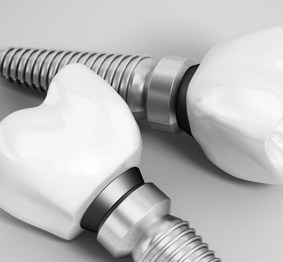 We Share a Wall With Another Dental Office. Here's Why Patients Still Choose Us for Implants.