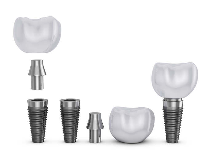Types of Dental Implants in Rockville, MD